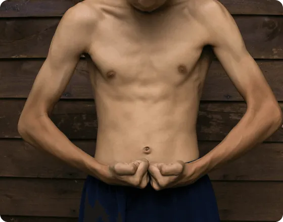 Perte de masse musculaire